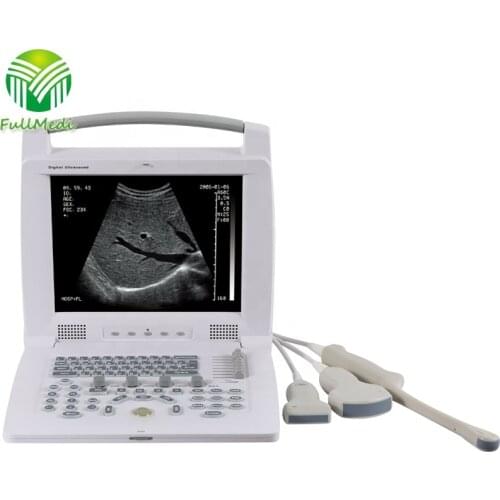 FM-308I New Type Cheap Black / White Full Digital Laptop Ultrasound Scanner Machine with CE Certificate