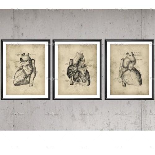 Nordic Vintage Heart Anatomy Poster Cardiology Modular Picture Wall Art Medical Art Clinic Decor SurgeonGift Doctor Office Decor