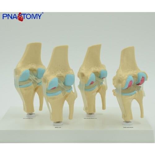 Knee Joints Synthesis Model,life Size Anatomical Model Anatomy Specimen Medical Sciences Educational Equipment