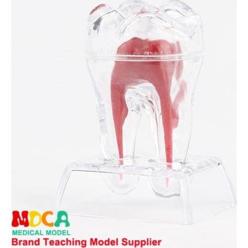 Dental anatomy models dental materials dental accessories removable dental ornaments dental materials MYC002