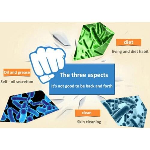 Herbal Anti Nose Mites Remove Acne Rosacea Cream Red Acne Blackhead Ointment Pores Bleaching Treatment Face Shrink Remover U8Q9