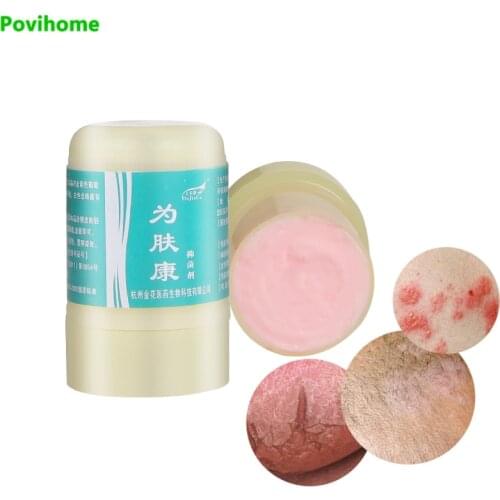 10g Eczema Psoriasis Dermatitis Pruritus Treatment Cream Chinese Medicine Herbal Ointment Anti-Itching Fungus Antipruritic