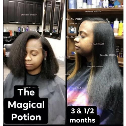 The Magical Fast GROW MAX XXL Beard & Mustache Accelerator - #1 FACIAL HAIR GROWTH OIL WORLDWIDE
