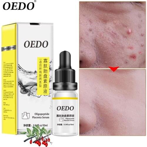 OEDO Oligopeptide Placenta Serum Face Cream Acne Treatment Skin Care Repair Whitening Anti Anging Winkles Essence Moisturizing