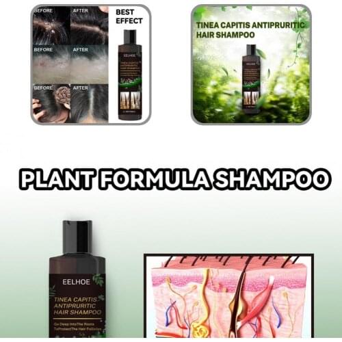Improve Hair Quality Universal Anti-dandruff Anti-itch Shampoo for Home Use
