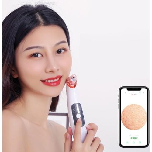 Electric Vacuum Cleaner Blackhead Cleaner Pore Cleanser Face Care