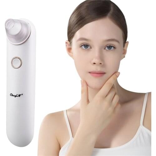 CkeyiN Vacuum Acne Remover Comedo Extractor Electric Blackhead Suction Tool Facial Pore Deep Cleansing Beauty Care USB Charging