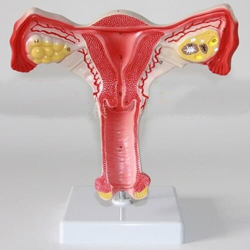 Ovarian Uterine anatomical model of Obstetrics and Gynecology