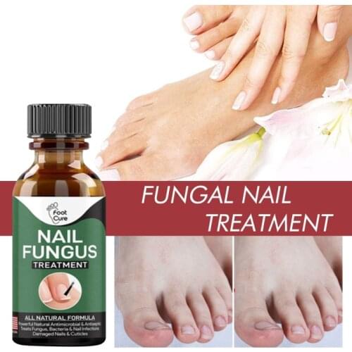 2021 HOT Liquid Nail Fungal Pen Fungus Treatment Finger Toe Anti-Fungal Nail Repair Nail Care Nail Treatment Wholesale TSLM1