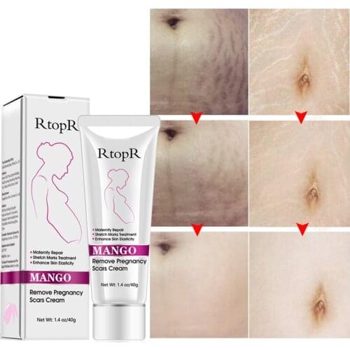 Pregnancy Scar Removal Cream Pregnant Women Pigment Correction Repair Body Gel Firming and Brightening Stretch Marks 40g