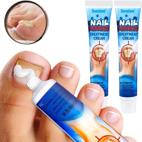 20g Nail Fungus Removal Cream Ointment Onychomycosis Fungal Nail Anti Infection Treatment Paronychia Feet Toe Fungal Nail Care