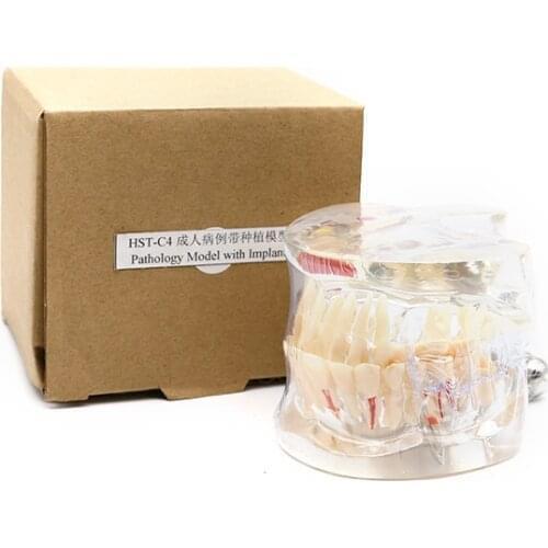 1 pcs Teeth Model Pro Adult White Teeth Model Standard Dental Teaching Study Typodont Demonstration Oral Medical Education Tools