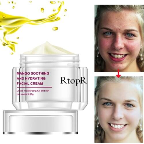 RtopR Mango Facial Cream Moisturizers Treatment Scar Blackhead Cream Shrink Pores Whitening Moisturizing Facial Skin Care