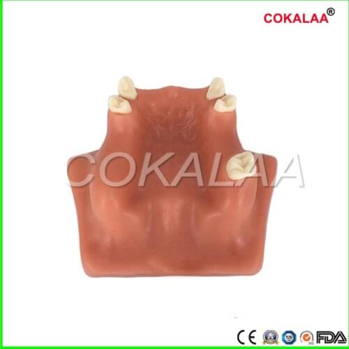 COKALAA Dental Upper Jaw Sinus Lift Practice Model, Medical Science Educational Teaching Models