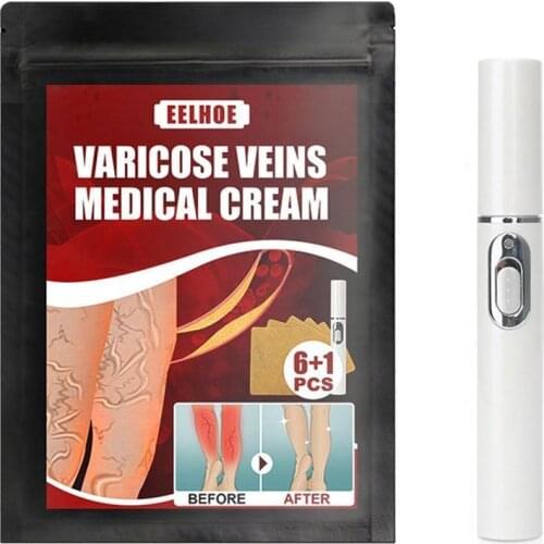 Medical Blue Light Therapy Pen Varicose Veins Treatment Black Plaster Spider Leg Soft Scar Removal Patch Kit Spot