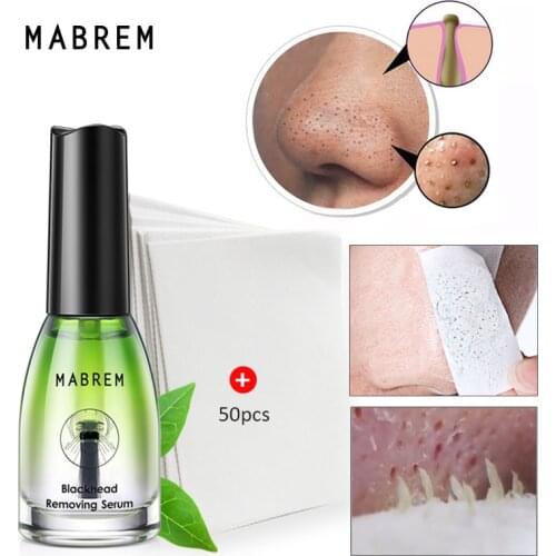 Blackhead Peeling Mask Deep Cleansing Pores Nose Strip Paper 50pcs Acne Treatment Oil Control Black Mask Face Skin Care MABREM