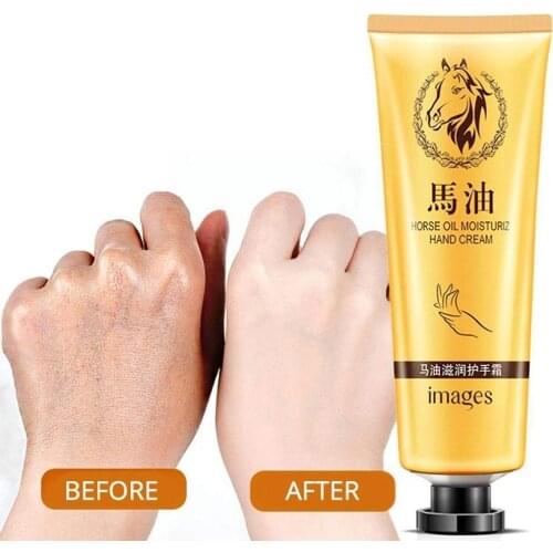 Hand Cream From Crack Foot Repair For Dri Sky Roughness Peeling Snake Palm Moistur Oil Winter Barb Dryness Frost U5B1