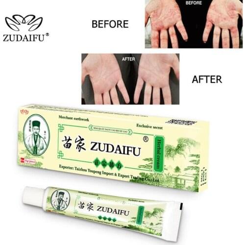 60pcs Wholesale Zudaifu Skin Psoriasis Cream Dermatitis Eczematoid Eczema Ointment Treatment Psoriasis Cream Skin Cream With BOX