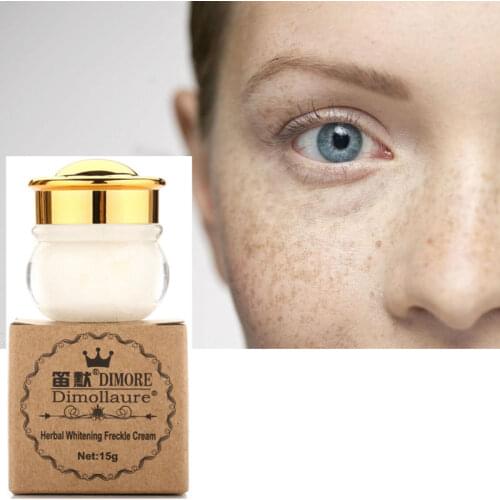 Dropshipping Dimollaure Strong Removal melasma whitening cream Freckle speckle sunburn Spots pigment Melanin scar removal cream
