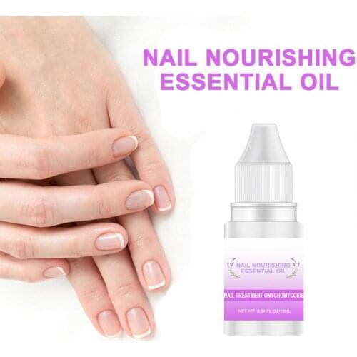 Nail Care Liquid Herbal Plant Nail Finger Edge Oil Nail Care Nutrient Oil Anti-dead Skin Barb Nail Repair Essential Oil