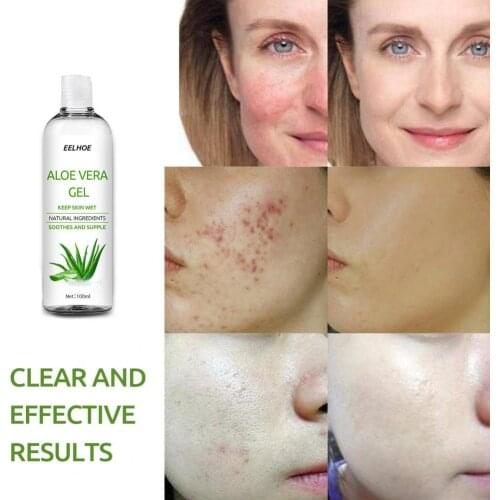 30ML/50ML/100ML/Bottle Functional Aloe Gel Nourishing Wide Application Mild Skin Aloe Vera Gel Daily Life for Women Skin Care