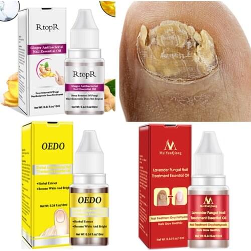 Fungal Nail Treatment Serum Onychomycosis Paronychia Anti-Fungal Nail Infection Herbal Toe Fungus Foot Repair Essence Care 10ml
