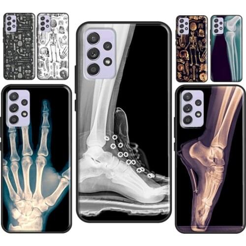 X-Ray Human Anatomy For Samsung A21S A20e M31S A71 A51 A41 A31 A11 A70 A50 A12 A32 A42 A52 A72 Phone Cover