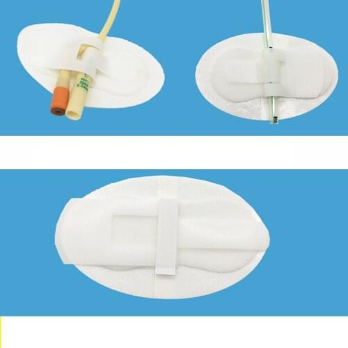 20/10/1pc non-woven adhesive holder foley catheter holder homecare fixed stick catheter care sterilized fixed tube size11*6cm 5