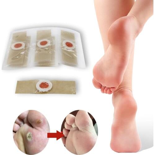 Corn plaster Medical Plasters Wart Remover Corn Removal Patch 60Pcs/10box Warts Thorn Curative Patches Calluses Remove Callosity