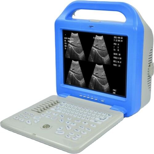 High resolution image Ultrasound scanner with ultrasound Convex/Linear/Trans-vaginal probe