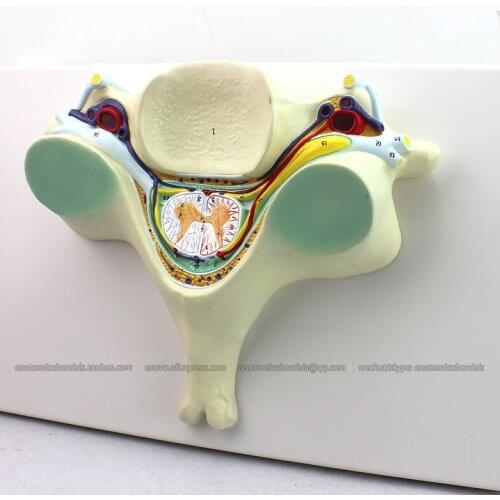 CMAM/12394 Fifth Cervical Vertebra with Spinal Cord and Nerve, 7x, Medical Backbone Anatomical Human Model