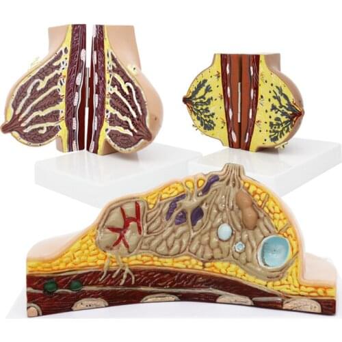 Lactation breast model Chest Breast anatomy Breast disease model Prolactinist teaching aids