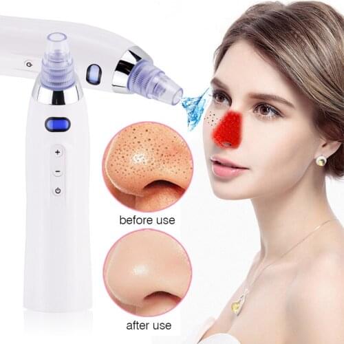 Vacuum Pore Black Spot Blackhead Facial Acne Clean Exfoliating Cleansing Tightening Skin Face Instrument Diamond Dermabrasion
