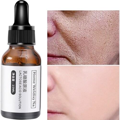 15ML Lactose Acid Extracts Face Serum Shrink Pores Essence Anti-Aging Shrink Pore Whitening Moisturizing Essence Face Cream TSLM