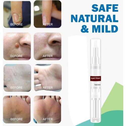 Natural Health Skin Tags Remover 12 Hours Mole Genital Wart Foot Corn Removal Fast Effective Corn Calluses Wart removal Pen 3ml