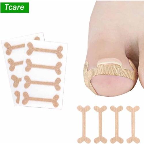 3Set/Lot Toe Nail Groove Foot Nail Orthodontic Device Thumb Nail Patch Quick Pedicure Toe Nail Deformation Recover Foot Care