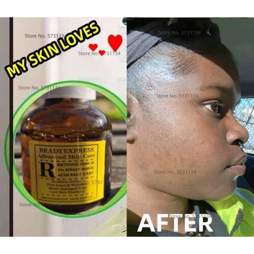 BRADYEXPRESS Face Serums