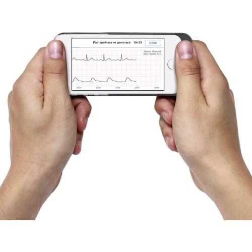 CardioQVARK Smart Electronics