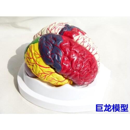 Human color brain detachable Medical teaching model Doctor-patient communication