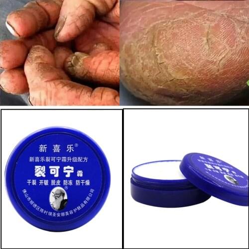 Traditional Chinese 33g Oil Anti-Drying Crack Foot Cream Heel Cracked Repair Cream Removal Dead Skin Hand Feet Care