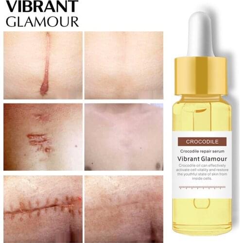 VIBRANT GLAMOUR Crocodile Dispel Scar Repair Face Serum Remove Acne Scar Stretch Marks Treatment Skin Lightening Whitening Care
