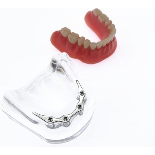 Mandibular jaw model with silcone for incision inplant sture M2027