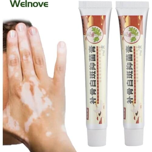 20g White Spot Ointment Vitiligo Cream Cure Antibacterial Cream Localized Mycosis Leukoplakia Plaster Promote Pigment Melanin