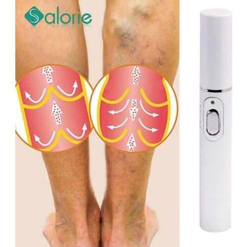 Blue Light Therapy Pen for Varicose Veins Therapy Wrinkle Acne Laser Pen