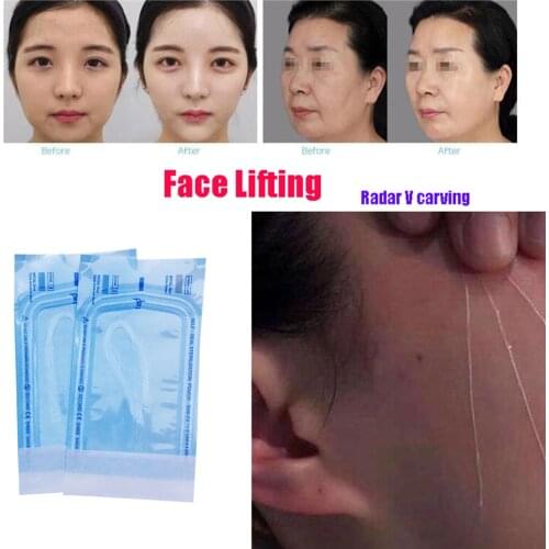 50pcs No Needle Silk Fibroin Line Carving Essence Collagen Radar Thread Hyaluronic Tightening Skin Facial Thread Lift Anti Aging