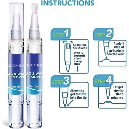 3ml Wart Removal With 36 Stickers Wart Removal Patches Wart Moles Set Against Care Combination Removal Skin D7S5