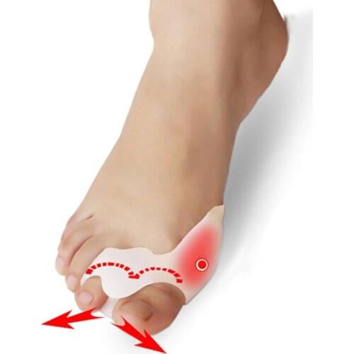 4 Pieces=2 Pairs Hallux Valgus Braces Toes Correction Broadhurst Pad Sub-toe Toe Separator Remedical Daily Foot Care