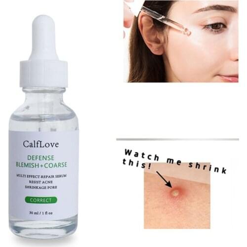 30ml Salicylic Acid Solution Face Serum Oil Control Shrink Pores Face Essence Serum Acne Treatment Smooth Skin Care