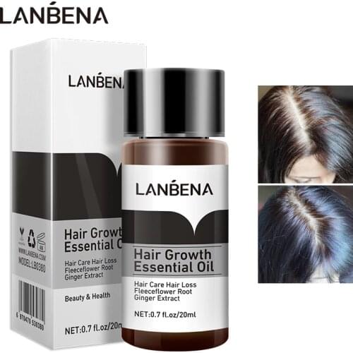 LANBENA Fast Powerful Hair Growth Essence Products Essential Oil Treatment Preventing Hair Loss Hair Care Andrea 20ml