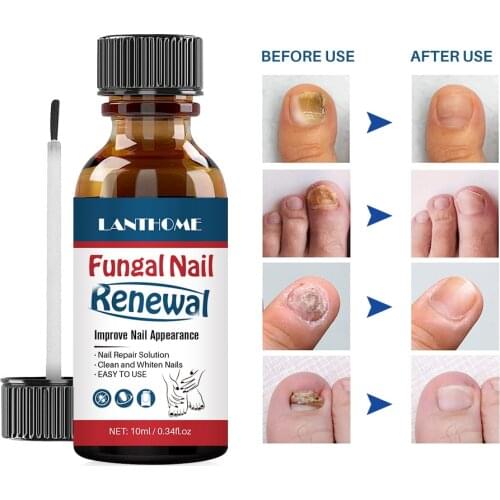 Natural nail strengthener growth cuticle oil Nail Liquid Repair Treatment Nail Toe Fungus Removal Moisturizing Nail Foot Care